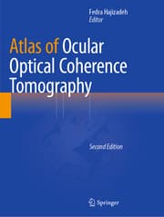 Cover von Atlas of Ocular Optical Coherence Tomography