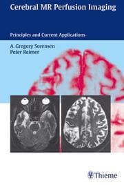 Cover von Cerebral MR Perfusion Imaging