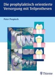 Cover von Die prophylaktisch orientierte Versorgung mit Teilprothesen