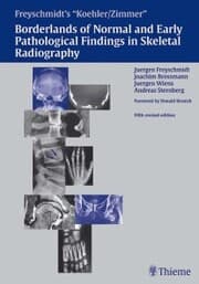 Cover von Freyschmidt's 'Koehler/Zimmer' Borderlands of Normal and Early Pathological Findings in Skeletal Radiography
