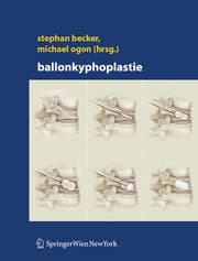 Cover von Ballonkyphoplastie