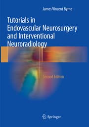 Cover von Tutorials in Endovascular Neurosurgery and Interventional Neuroradiology