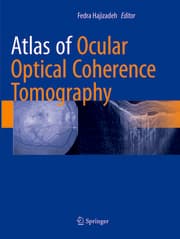Cover von Atlas of Ocular Optical Coherence Tomography