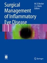 Cover von Surgical Management of Inflammatory Eye Disease