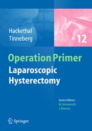 Cover von Laparoscopic Hysterectomy