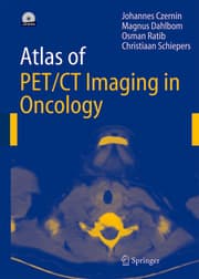 Cover von Atlas of PET/CT Imaging in Oncology