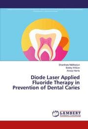 Cover von Diode Laser Applied Fluoride Therapy in Prevention of Dental Caries