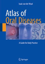 Cover von Atlas of Oral Diseases