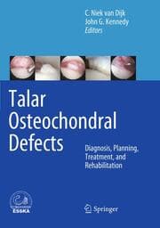 Cover von Talar Osteochondral Defects