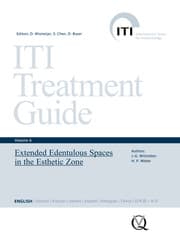 Cover von Extended Edentulous Spaces in the Esthetic Zone