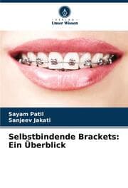 Cover von Selbstbindende Brackets: Ein Überblick