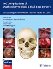 Cover von 100 Complications of Otorhinolaryngology & Skull Base Surgery